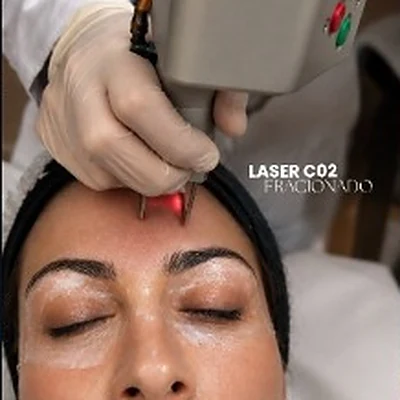 Aplicação de laser CO2 fracionado na Clínica Canetti